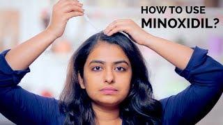 How To Use Minoxidil  Hair Regrowth  Skin Diaries