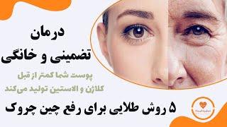 5 روش طلایی برای رفع چین و چروک صورت  درمان خانگی ساده و کاربردی