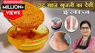 Eczema Home Made Remedy  घरेलू नुस्खे से दूर होगी खुजली और सूजन बचेंगे पैसेकभी नही होगा इंफेक्शन