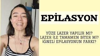 YÜZE LAZER YAPILIR MI İĞNELİ EPİLASYON NEDİR BEN NASIL BİTİRDİM 