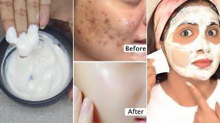 3 Days Skin Transformation-Get rid of skin blemishes spots large pores-get bright tight glass skin