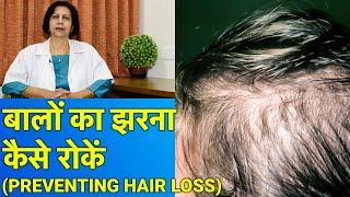 बाल झरना कैसे रोकें और उसका इलाज  Treatment of Hair FallHair Loss