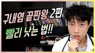 구내염 끝판왕 2편 - 빨리 낫는 법 l 닥터딩요