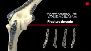 WINSTA-E®  Fractura codo