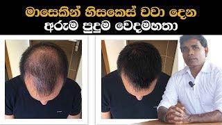 මාසෙකින් හිසකෙස් වවා දෙන අරුම පුදුම වෙදමහතා  Hair growth ayurvedic treatment By Doctor Dayashantha