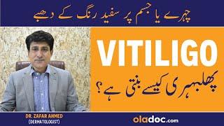Vitiligo Symptoms & Treatment - Phulbehri Ka Ilaj In UrduHindi - Skin Pe White Spots Kyu Hote Hain