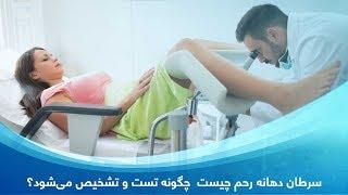 سرطان دهانه رحم cervical cancerچیست و چگونه تست تشخیص می‌شود؟