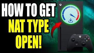 How to Get NAT Type Open on Xbox Series XS - Faster Downloads Lower Ping and Fix LAG