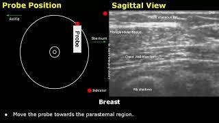 Breast Ultrasound Probe Positioning  Sagittal Radial Views & Clock System USG Transducer Placement