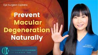 How to Prevent Macular Degeneration NATURALLY - 5 Tips  Eye Surgeon Explains #draudreytai