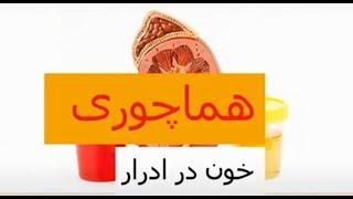 هماچوری یا خون در ادرار - دکتر سید امین میرصادقی