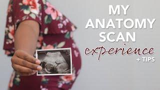 20 Week Anatomy Scan What to Expect + Tips
