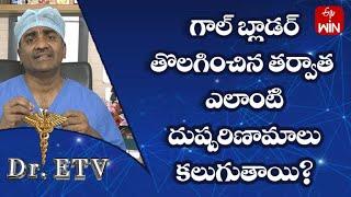 Does Side Effects Getting After Gallbladder Removal?  Dr.ETV  27th April 2023  ETV Life