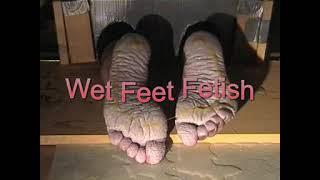 Wrinkled feet with fire