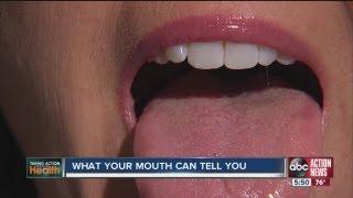 Taking Action for Your Health  What your mouth can tell you about your body