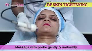 Radio Frequency  RF Skin Tightening        Sakhiya Skin Clinic