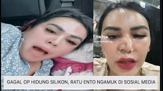 GAGAL OP HIDUNG SILIKON RATU ENTO NGAMUK DI SOSIAL MEDIA