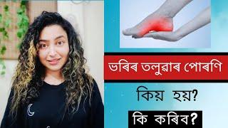 What Causes Feet Burning Sensation?  Assamese Health Video