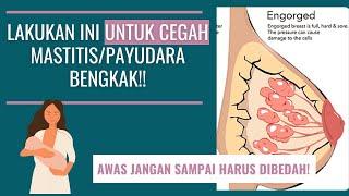 TIPS MENCEGAH PAYUDARA BENGKAKMASTITIS