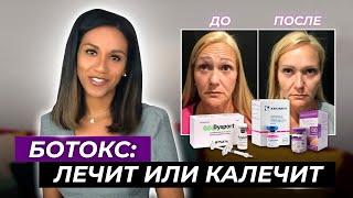 BOTOX Как убрать морщины лба морщины межбровья и гусиные лапки  Ботокс от морщин за и против