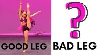 Mackenzies Bad Leg vs Good Leg Surprising