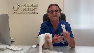 Protesi Peniena idraulica Tricomponente Antonini Urology Roma Madrid Milano