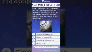 NEET MDS  INI-CET MDS  PSC  BDS - Most Important Questions  #neetmds2025 #mdsprep