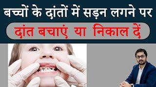 बच्चों के दाँत मे कीड़ा लगने का इलाज़  निकलवाएं या बचाएँ ?  Treatment of kids teeth in Indore