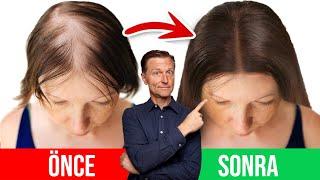 Saç Dökülmesini Önlemek İçin 5 En İyi Tavsiye  Dr.Berg Türkçe