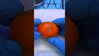 Worms in the tangerine Needs fruit surgery to remove the worms #shorts #fruitsurgery