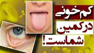 علائم کم خونی چیست و چطور آن را تشخیص دهیم؟