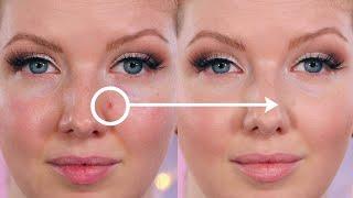 How to Cover and Conceal Acne Blemishes  Makeup Tutorial