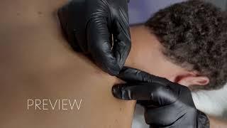 Extreme Trigger Point Release    Dry Needling    Painful
