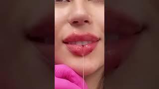 ANGELINA JOLIE LIP CLEAVAGE TECHNIQUE ️ #lipfiller