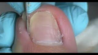 Satisfying toenail pedicure