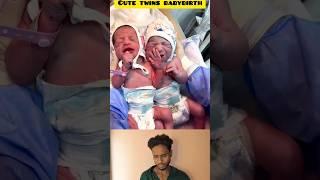 twins baby birth  #cutebaby #twins #newbornbaby #junior #birth  #babycare #viralvideo #vlog