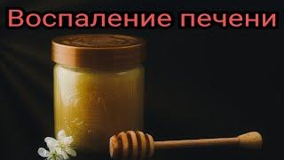 Воспаление печени. Народная медицина. Целитель. Доктор. Аптека.