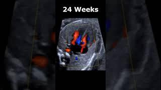 7-37 Weeks EmbryonicFetal Heartbeat Ultrasound Appearances  Baby Heart Motion USG #babyheartbeat