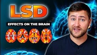 LSD’s Amazing Effects on the Brain