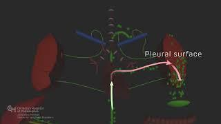 Chylothorax