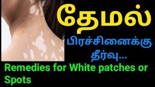 தேமல் பிரச்சனைக்கு தீர்வு Remedies for White patches or Spots #HappyMom #subscribe #tamil #2024