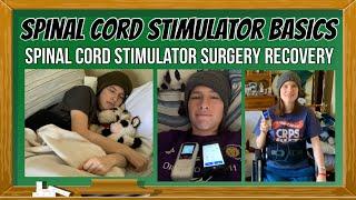 Spinal Cord Stimulator Surgery Recovery Experience