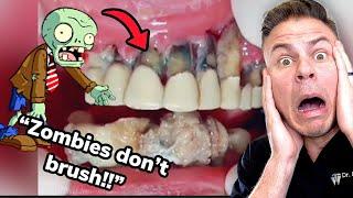 If Zombies Went To The Dentist