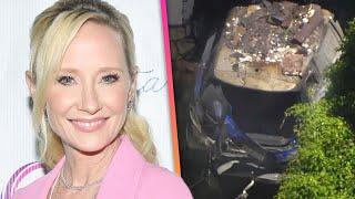 Anne Heche Under Investigation for DUI Hit-and-Run for Car Crash