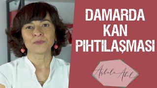 DAMARDA KAN PIHTILAŞMASI Op.Dr. Aybala Akıl