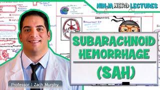 Subarachnoid Hemorrhage  Etiology Pathophysiology Clinical Features Treatment Complications