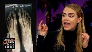 Cara Delevingne Sent X-Rays To Her Foot Fansite