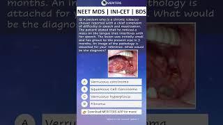 NEET MDS  INI-CET MDS  PSC  BDS - Most Important Questions  #neetmds2025 #mdsprep