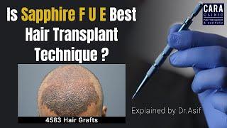 Is Sapphire FUE the Best Hair Transplant Technique?