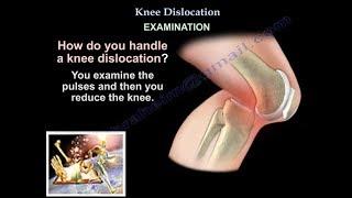 Knee Dislocation - Everything You Need To Know - Dr. Nabil Ebraheim